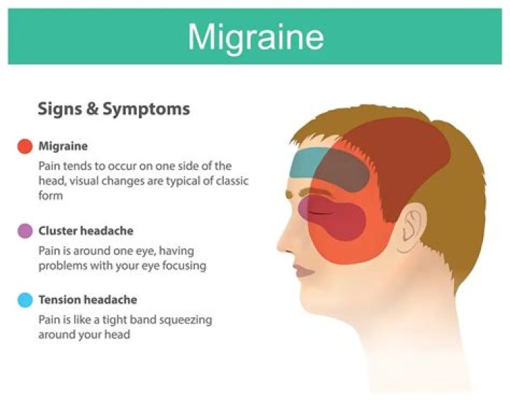 Are all migraines debilitating?