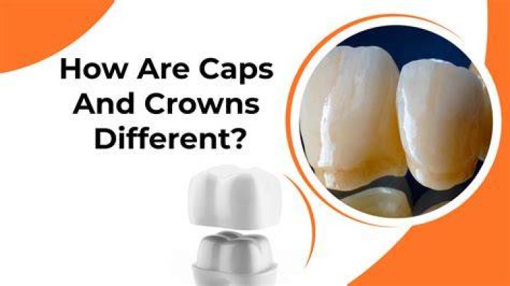 Are capped teeth the same as crowns?