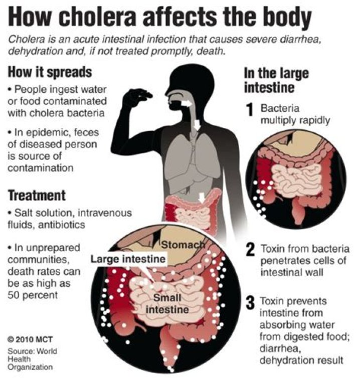 Are cholera and diarrhea?