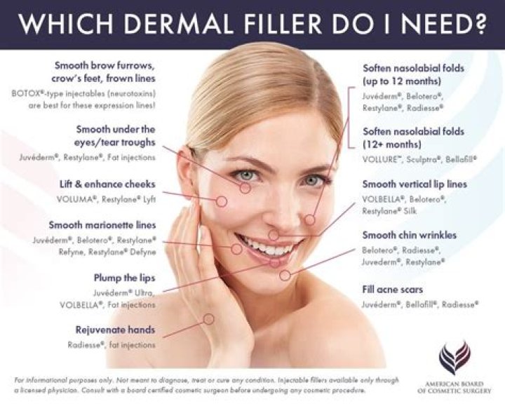 Are filler injections instant?