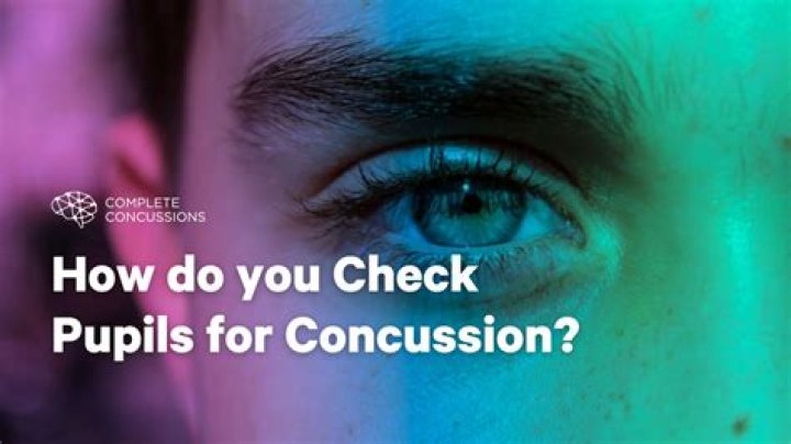 Are pupils dilated with concussion?