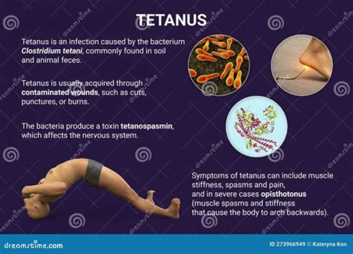Are tetany and tetanus the same?