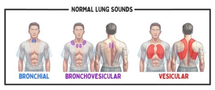 Are vesicular breath sounds normal?