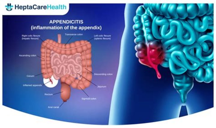 At what age can you get appendicitis?
