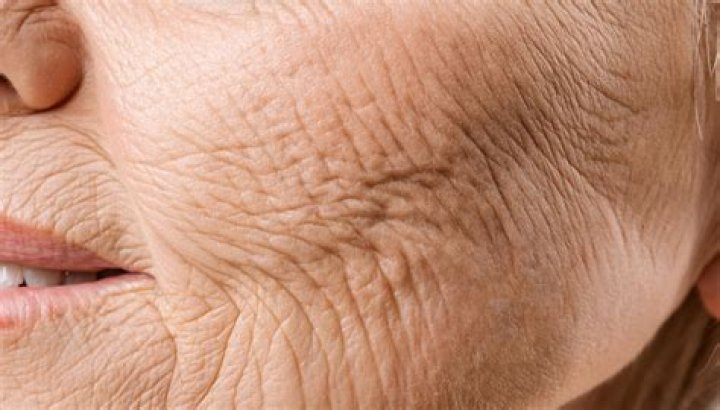 At what age does skin wrinkle?