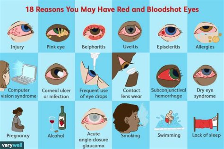 Can a person have red eyes?