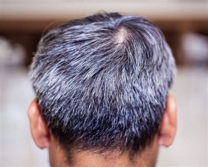 Can a strand of hair turn gray?