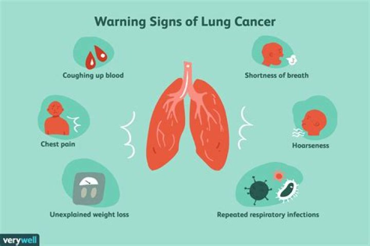 Can a tickly cough be a sign of lung cancer?