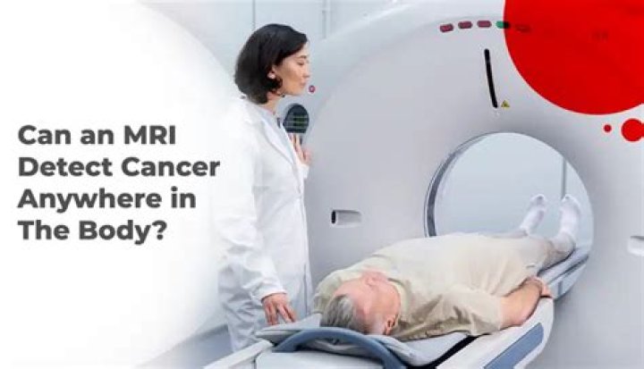 Can an mri detect cancer?