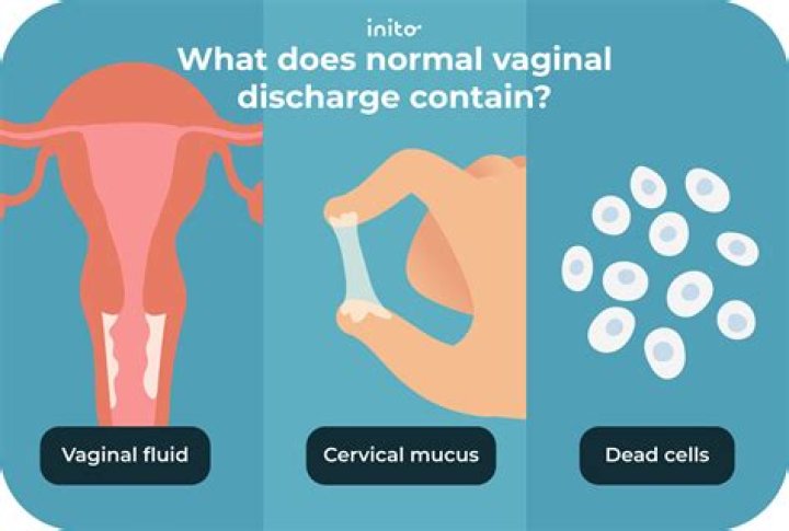Can discharge be clumpy?