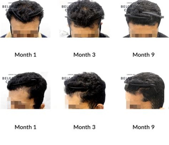Can hair grow one inch per month?