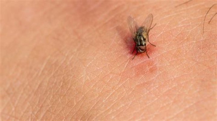 Can phorid flies make you sick?