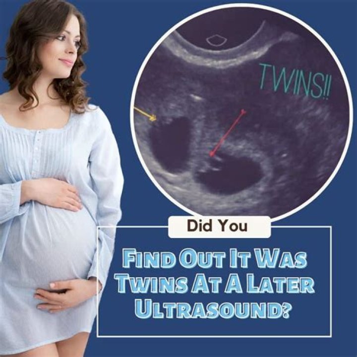 Can scans miss twins?