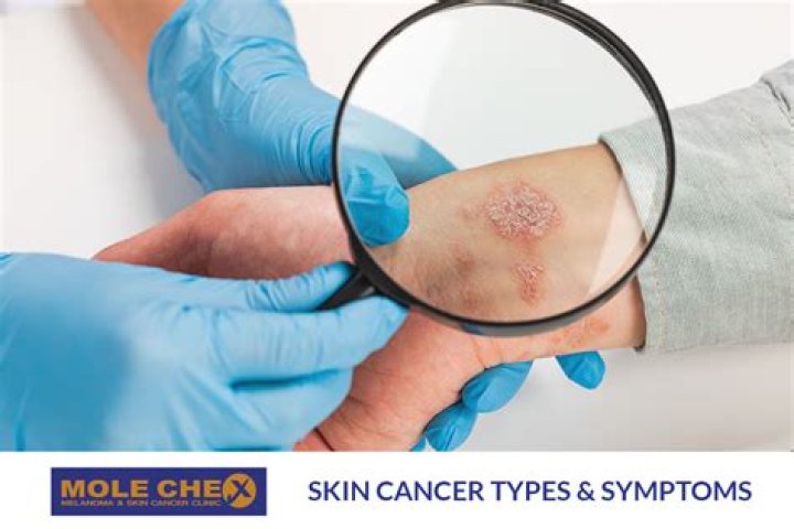 Can scratching skin cause cancer?