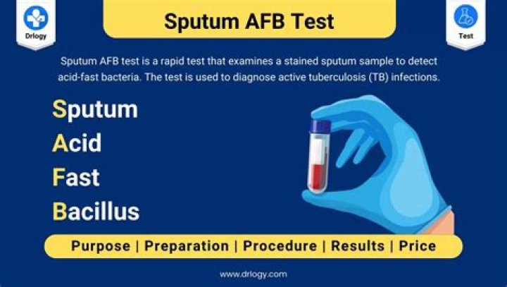Can sputum test detect tb?