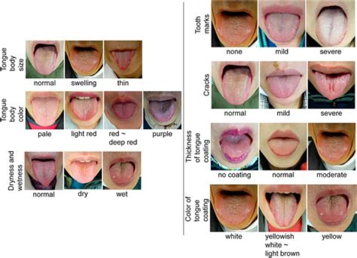 Can tongues be translated?