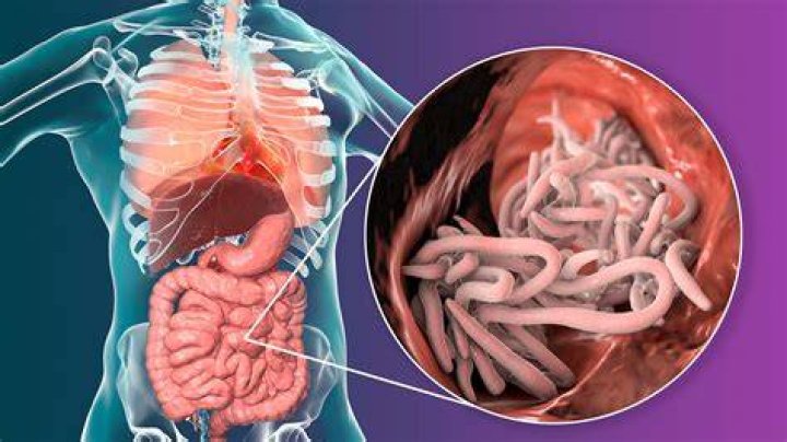 Can you feel ascariasis?