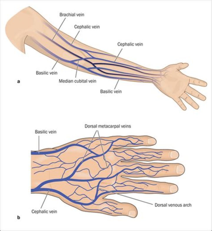 Can you have a cannula in your arm?