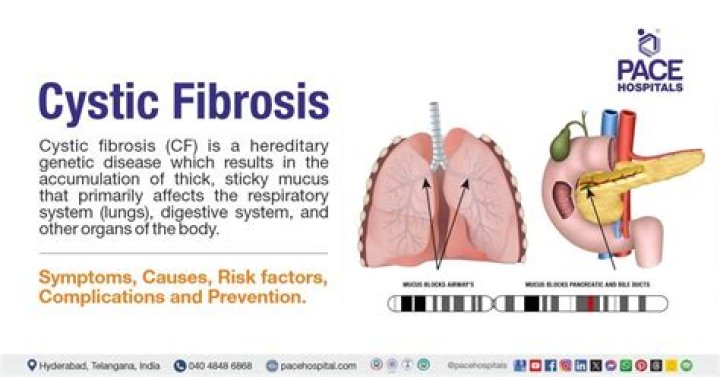 Did jorge bacardi have cystic fibrosis?