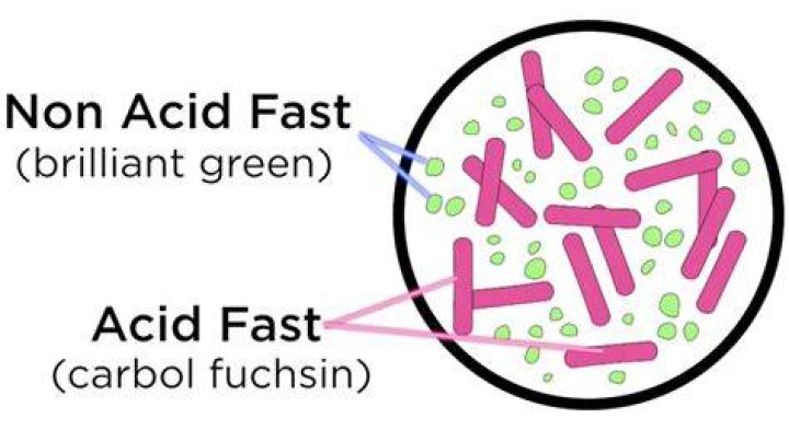 Did the acid fast stain sputum?
