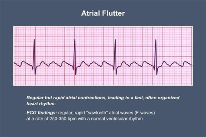 Did your heart flutter?
