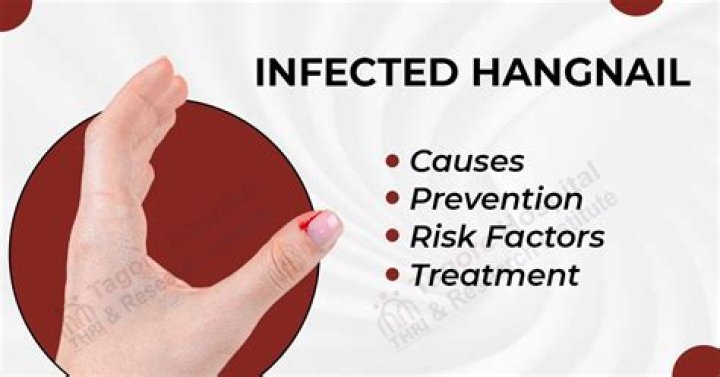 Do all hangnails hurt?