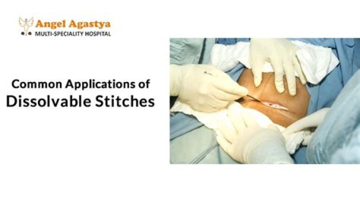Do catgut stitches dissolve?