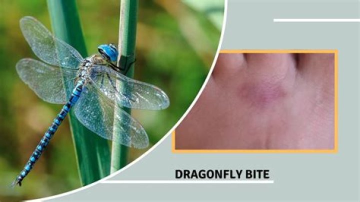 Do dragonflies bite you?