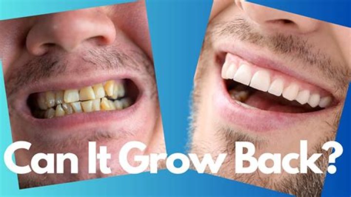 Do enamel grow back?