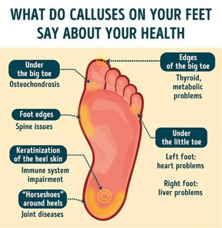 Do foot calluses hurt?