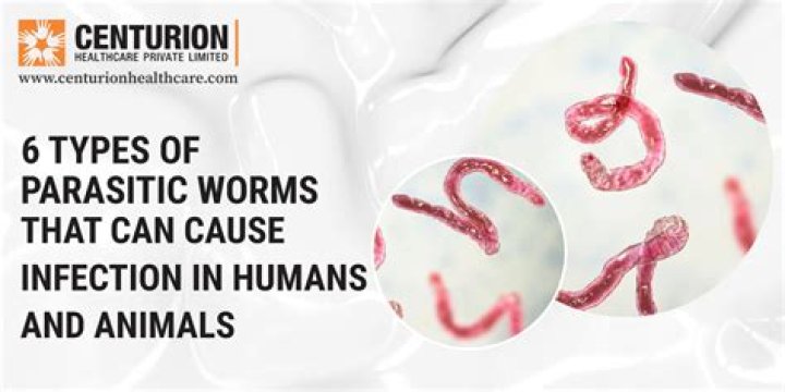 Do hair have worms?