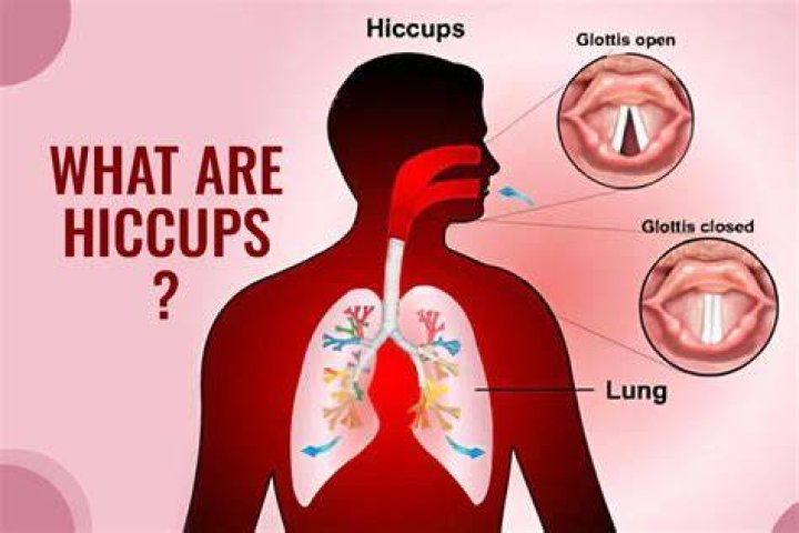 Do hiccups hurt babies?