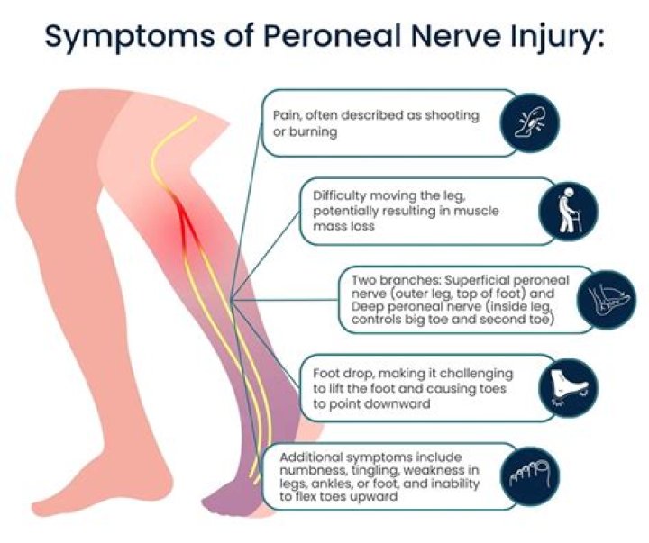 Do mris show nerve damage?