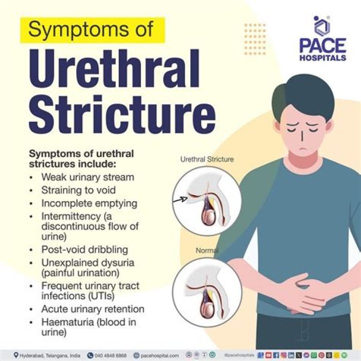 Do urethral strictures go away?