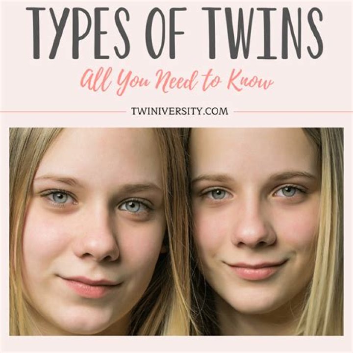 Do you show earlier with twins?