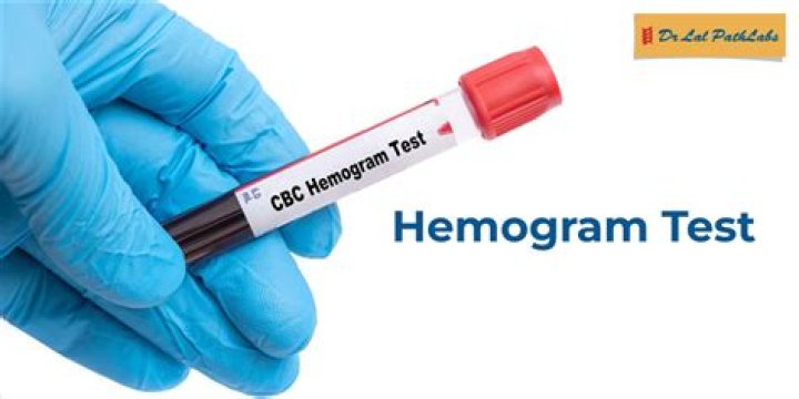 Does a hemogram include platelets?
