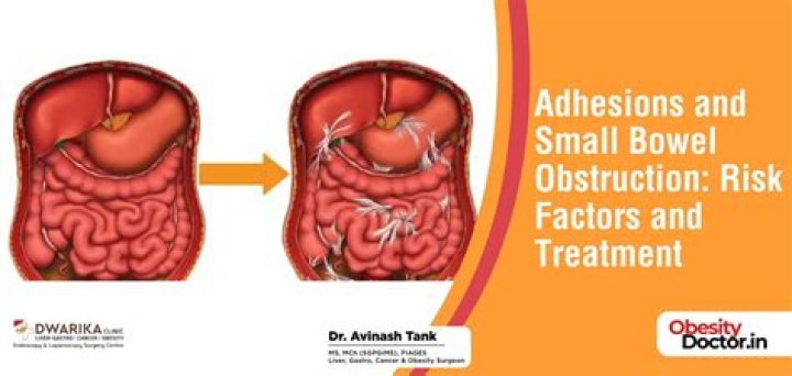 Does adhesions cause diarrhea?