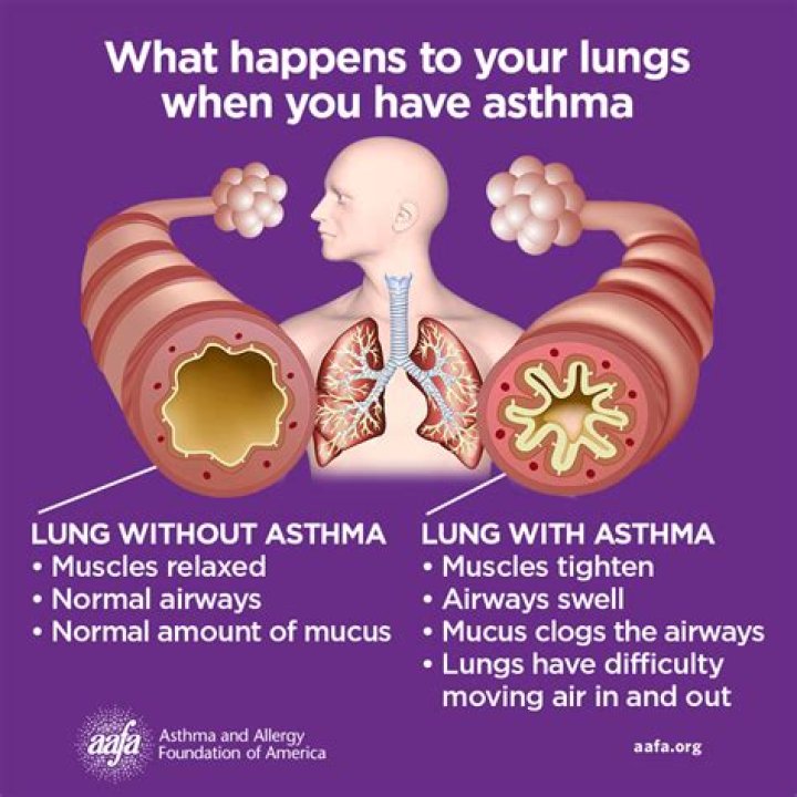 Does bronchitis mean asthmatic?