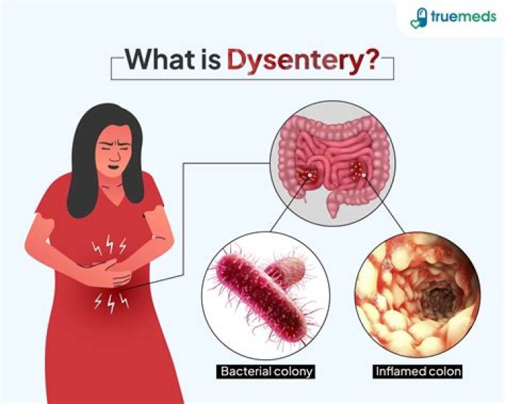 Does cholera cause dysentery?