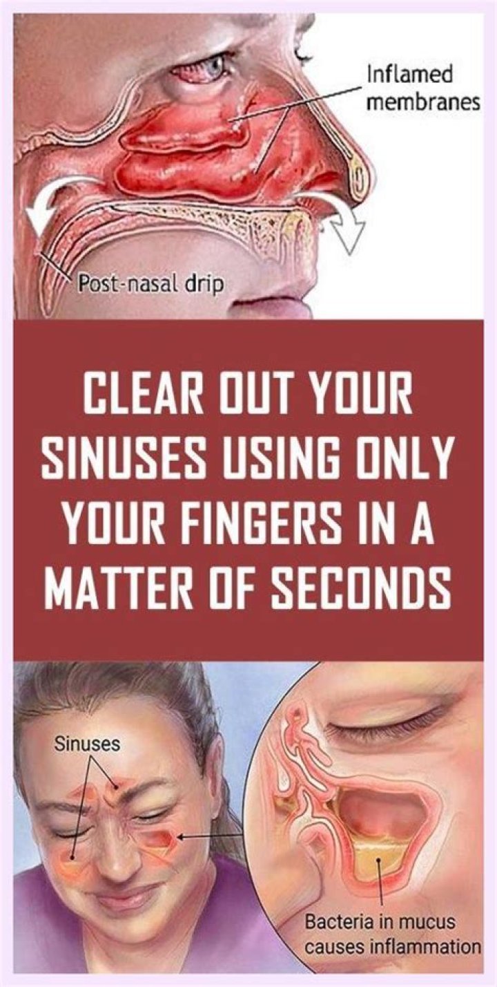Does cold air clear your sinuses?