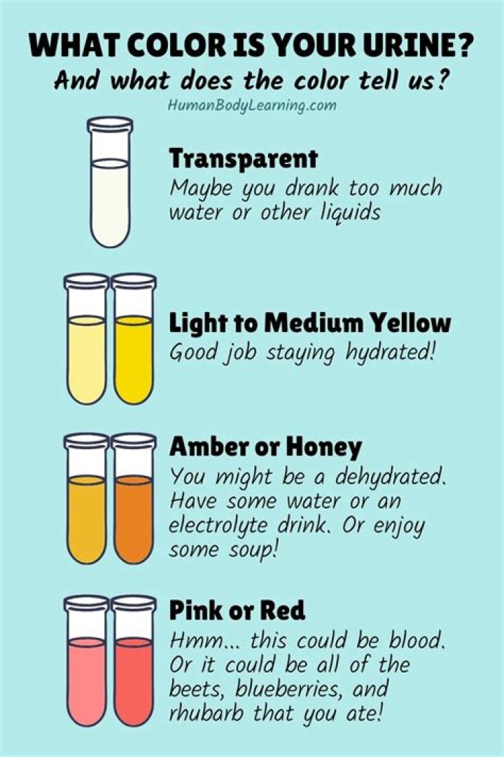 Does color of urine mean anything?