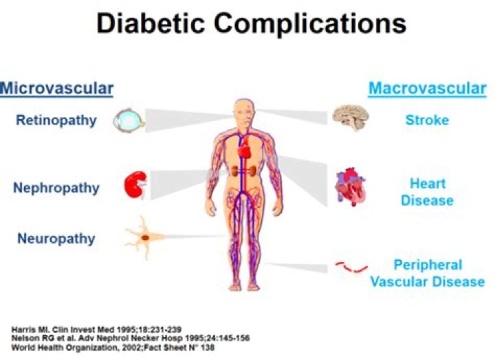 Does diabetes affect perfusion?