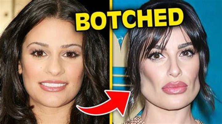 Does e pay for botched surgeries?