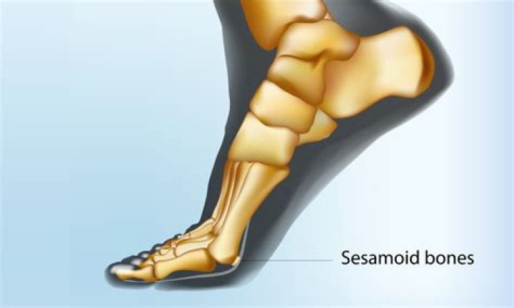 Does everyone have sesamoid bones?