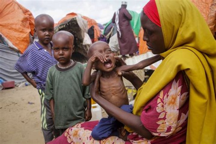 Does france have famine?