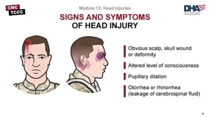 Does head injuries make you tired?