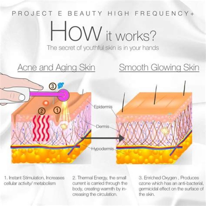 Does high frequency treatment work?