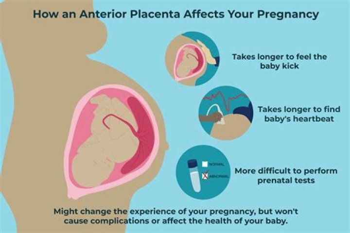Does it hurt if your placenta detaches?