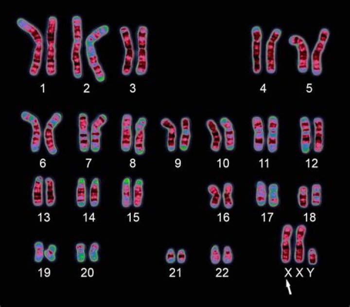 Does karyotype show genetic disorders?