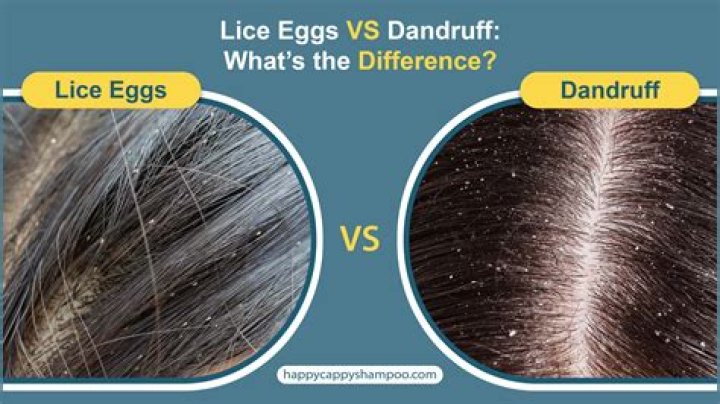 Does lindane kill lice eggs?